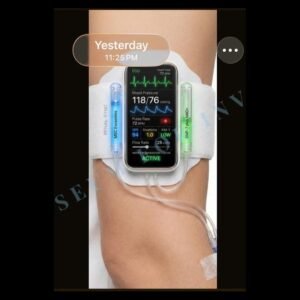 SRX Renal-Sync Wearable Infusion Unit (Concept)